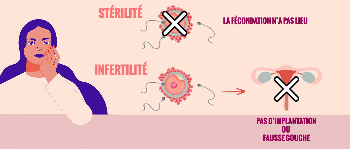 Stérilité et infertilité quelle est la différence ?